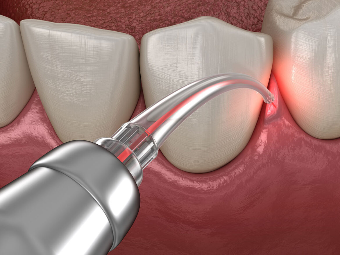The Link Between Gum Disease and Heart Disease