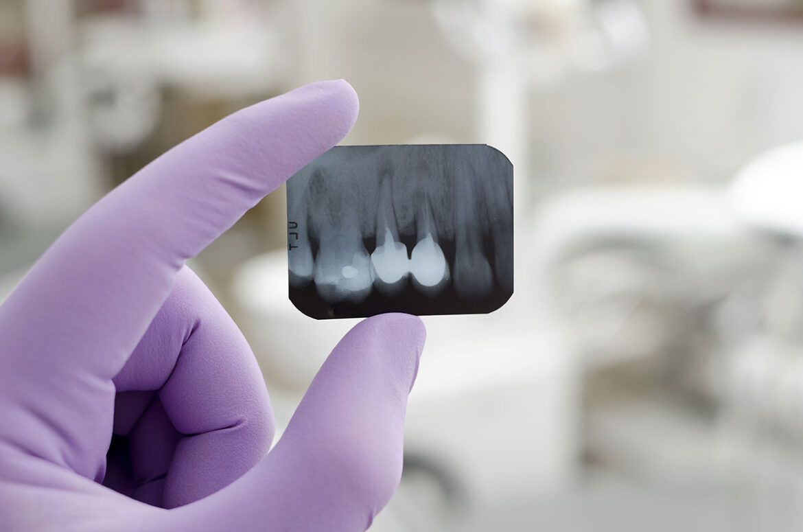 How to Prevent Gum Disease and Maintain a Healthy Smile
